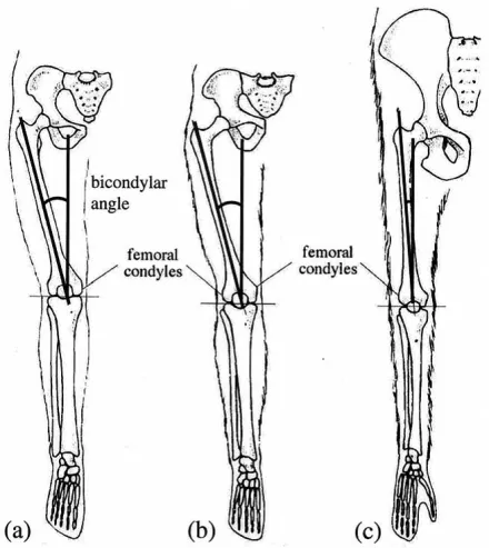 Bicondylar angles